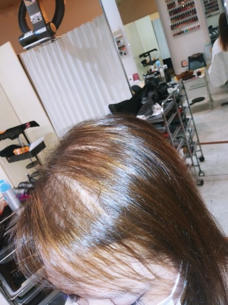 アフター